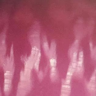 海螺珠最新价格走势及分析