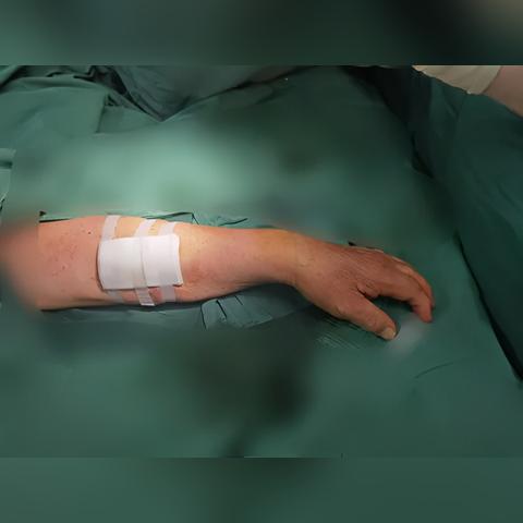 透析指征更新，肾脏疾病治疗的新金标准